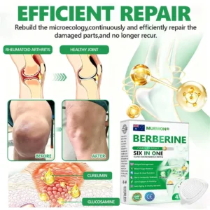 ๐๐ฎ๐ฌ๐ฌ๐ข๐ ๐๐จ๐๐ญ๐จ๐ซ ๐๐๐๐จ๐ฆ๐ฆ๐๐ง๐๐๐ ๐จโโ๏ธ | ๐ด๐ผ๐น๐พ๐ถ๐ตยฎ ๐๐ฒ๐ฟ๐ฏ๐ฒ๐ฟ๐ถ๐ป๐ฒ ๐ฒ-๐ถ๐ป-๐ญ ๐ก๐ฎ๐ป๐ผ ๐ ๐ถ๐ฐ๐ฟ๐ผ๐ป๐ฒ๐ฒ๐ฑ๐น๐ฒ ๐ฃ๐ฎ๐๐ฐ๐ต ๐| ๐ด๐๐ฃ๐๐๐๐๐ 6-๐๐-1 ๐๐๐๐๐ข๐๐ | โจ ๐๐๐ ๐๐๐๐ ๐๐๐ ๐ข๐๐ก๐ ๐๐ ๐๐ ๐๐๐ก๐ก๐๐ ๐๐ 7 ๐๐๐ฆ๐ ๐