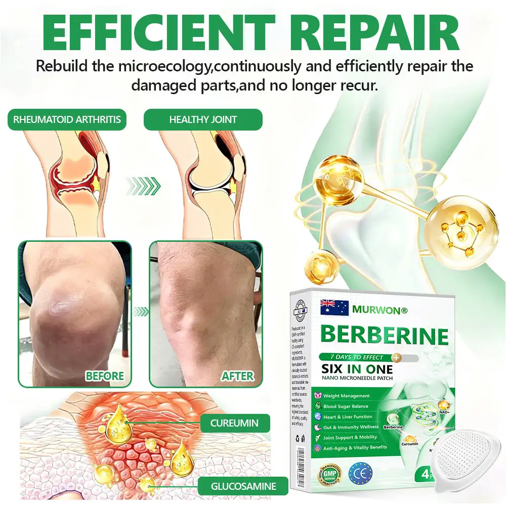 ๐๐ฎ๐ฌ๐ฌ๐ข๐ ๐๐จ๐๐ญ๐จ๐ซ ๐๐๐๐จ๐ฆ๐ฆ๐๐ง๐๐๐ ๐จโโ๏ธ | ๐ด๐ผ๐น๐พ๐ถ๐ตยฎ ๐๐ฒ๐ฟ๐ฏ๐ฒ๐ฟ๐ถ๐ป๐ฒ ๐ฒ-๐ถ๐ป-๐ญ ๐ก๐ฎ๐ป๐ผ ๐ ๐ถ๐ฐ๐ฟ๐ผ๐ป๐ฒ๐ฒ๐ฑ๐น๐ฒ ๐ฃ๐ฎ๐๐ฐ๐ต ๐| ๐ด๐๐ฃ๐๐๐๐๐ 6-๐๐-1 ๐๐๐๐๐ข๐๐ | โจ ๐๐๐ ๐๐๐๐ ๐๐๐ ๐ข๐๐ก๐ ๐๐ ๐๐ ๐๐๐ก๐ก๐๐ ๐๐ 7 ๐๐๐ฆ๐ ๐