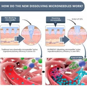 𝑴𝑼𝑹𝓦𝙊𝓝® 𝑩𝒆𝒓𝙗𝙚𝙧𝙞𝒏𝒆 & 𝑵𝘼𝘿 & 𝐆𝐫𝐚𝐩𝐡𝗲𝗻𝗲 10-𝙞𝒏-1 𝑵𝓪𝓷𝒐 𝑴𝒊𝒄𝒓𝒐𝓷𝒆𝒆𝒅𝒍𝒆 𝒑𝒂𝒕𝓬𝒉👩‍⚕️💧|🏅𝐆𝐫𝐚𝐩𝐡𝗲𝗻𝗲 𝗽𝗲𝗿𝗺𝐞𝐚𝐛𝐢𝐥𝐢𝐭𝐲 𝐮𝐩 𝐭𝐨 𝟗𝟖%|𝙎𝙪𝙞𝙩𝙖𝙗𝙡𝙚 𝙛𝙤𝙧 𝙨𝙠𝙞𝙣 𝙩𝙞𝙜𝙝𝙩𝙚𝙣𝙞𝙣𝙜, 𝙬𝙚𝙞𝙜𝙝𝙩 𝙡𝙤𝙨𝙨, 𝙖𝙣𝙙 𝙗𝙡𝙤𝙤𝙙 𝙨𝙪𝙜𝙖𝙧 𝙗𝙖𝙡𝙖𝙣𝙘𝙚 ✅ 𝘽𝙖𝙘𝙠𝙚𝙙 𝙗𝙮 𝙨𝙘𝙞𝙚𝙣𝙘𝙚 | 10-𝙞𝙣-1 𝙛𝙤𝙧𝙢𝙪𝙡𝙖 | 𝙍𝙚𝙨𝙪𝙡𝙩𝙨 𝙞𝙣 7 𝙙𝙖𝙮𝙨