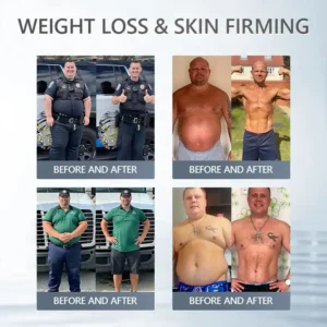 𝑴𝑼𝑹𝓦𝙊𝓝® 𝑩𝒆𝒓𝙗𝙚𝙧𝙞𝒏𝒆 & 𝑵𝘼𝘿 & 𝐆𝐫𝐚𝐩𝐡𝗲𝗻𝗲 10-𝙞𝒏-1 𝑵𝓪𝓷𝒐 𝑴𝒊𝒄𝒓𝒐𝓷𝒆𝒆𝒅𝒍𝒆 𝒑𝒂𝒕𝓬𝒉👩‍⚕️💧|🏅𝐆𝐫𝐚𝐩𝐡𝗲𝗻𝗲 𝗽𝗲𝗿𝗺𝐞𝐚𝐛𝐢𝐥𝐢𝐭𝐲 𝐮𝐩 𝐭𝐨 𝟗𝟖%|𝙎𝙪𝙞𝙩𝙖𝙗𝙡𝙚 𝙛𝙤𝙧 𝙨𝙠𝙞𝙣 𝙩𝙞𝙜𝙝𝙩𝙚𝙣𝙞𝙣𝙜, 𝙬𝙚𝙞𝙜𝙝𝙩 𝙡𝙤𝙨𝙨, 𝙖𝙣𝙙 𝙗𝙡𝙤𝙤𝙙 𝙨𝙪𝙜𝙖𝙧 𝙗𝙖𝙡𝙖𝙣𝙘𝙚 ✅ 𝘽𝙖𝙘𝙠𝙚𝙙 𝙗𝙮 𝙨𝙘𝙞𝙚𝙣𝙘𝙚 | 10-𝙞𝙣-1 𝙛𝙤𝙧𝙢𝙪𝙡𝙖 | 𝙍𝙚𝙨𝙪𝙡𝙩𝙨 𝙞𝙣 7 𝙙𝙖𝙮𝙨