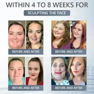 𝑴𝑼𝑹𝓦𝙊𝓝® 𝑩𝒆𝒓𝙗𝙚𝙧𝙞𝒏𝒆 & 𝑵𝘼𝘿 & 𝐆𝐫𝐚𝐩𝐡𝗲𝗻𝗲 10-𝙞𝒏-1 𝑵𝓪𝓷𝒐 𝑴𝒊𝒄𝒓𝒐𝓷𝒆𝒆𝒅𝒍𝒆 𝒑𝒂𝒕𝓬𝒉👩‍⚕️💧|🏅𝐆𝐫𝐚𝐩𝐡𝗲𝗻𝗲 𝗽𝗲𝗿𝗺𝐞𝐚𝐛𝐢𝐥𝐢𝐭𝐲 𝐮𝐩 𝐭𝐨 𝟗𝟖%|𝙎𝙪𝙞𝙩𝙖𝙗𝙡𝙚 𝙛𝙤𝙧 𝙨𝙠𝙞𝙣 𝙩𝙞𝙜𝙝𝙩𝙚𝙣𝙞𝙣𝙜, 𝙬𝙚𝙞𝙜𝙝𝙩 𝙡𝙤𝙨𝙨, 𝙖𝙣𝙙 𝙗𝙡𝙤𝙤𝙙 𝙨𝙪𝙜𝙖𝙧 𝙗𝙖𝙡𝙖𝙣𝙘𝙚 ✅ 𝘽𝙖𝙘𝙠𝙚𝙙 𝙗𝙮 𝙨𝙘𝙞𝙚𝙣𝙘𝙚 | 10-𝙞𝙣-1 𝙛𝙤𝙧𝙢𝙪𝙡𝙖 | 𝙍𝙚𝙨𝙪𝙡𝙩𝙨 𝙞𝙣 7 𝙙𝙖𝙮𝙨