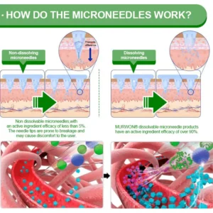🔥 Backed by science 👩‍⚕️ | 𝑴𝑼𝑹𝑾𝑶𝑵® 𝗕𝗲𝗿𝗯𝗲𝗿𝗶𝗻𝗲 𝟏𝟎-𝐢𝐧-𝟏 𝗡𝗮𝗻𝗼 𝗠𝗶𝗰𝗿𝗼𝗻𝗲𝗲𝗱𝗹𝗲 𝗣𝗮𝘁𝗰𝗵 | 𝐴𝑑𝑣𝑎𝑛𝑐𝑒𝑑 10-𝑖𝑛-1 𝑓𝑜𝑟𝑚𝑢𝑙𝑎 |  𝑉𝑖𝑠𝑖𝑏𝑙𝑒 𝑟𝑒𝑠𝑢𝑙𝑡𝑠 𝑖𝑛 𝑎𝑠 𝑙𝑖𝑡𝑡𝑙𝑒 𝑎𝑠 7 𝑑𝑎𝑦𝑠 👩‍⚕️