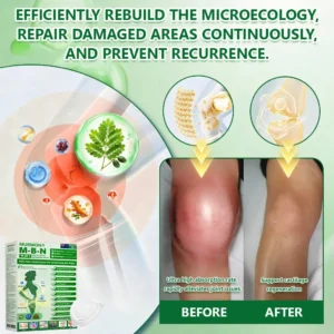 🔥 Backed by science 👩‍⚕️ | 𝑴𝑼𝑹𝑾𝑶𝑵® 𝗕𝗲𝗿𝗯𝗲𝗿𝗶𝗻𝗲 𝟏𝟎-𝐢𝐧-𝟏 𝗡𝗮𝗻𝗼 𝗠𝗶𝗰𝗿𝗼𝗻𝗲𝗲𝗱𝗹𝗲 𝗣𝗮𝘁𝗰𝗵 | 𝐴𝑑𝑣𝑎𝑛𝑐𝑒𝑑 10-𝑖𝑛-1 𝑓𝑜𝑟𝑚𝑢𝑙𝑎 |  𝑉𝑖𝑠𝑖𝑏𝑙𝑒 𝑟𝑒𝑠𝑢𝑙𝑡𝑠 𝑖𝑛 𝑎𝑠 𝑙𝑖𝑡𝑡𝑙𝑒 𝑎𝑠 7 𝑑𝑎𝑦𝑠 👩‍⚕️