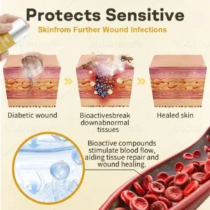 Healrize®GlucoShield Bee Venom Wound Spray