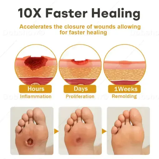 Healrize®GlucoShield Bee Venom Wound Spray