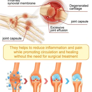 30% Discount🎁🎁|𝐌𝐔𝐑𝐖𝐎𝐍® Bee Venom Pain-Relief Bone Healing Cream ✨✨✨(Specially for older adults)