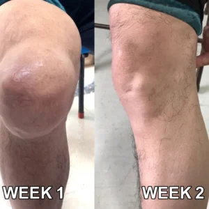 30% Discount🎁🎁|𝐌𝐔𝐑𝐖𝐎𝐍® Bee Venom Pain-Relief Bone Healing Cream ✨✨✨(Specially for older adults)